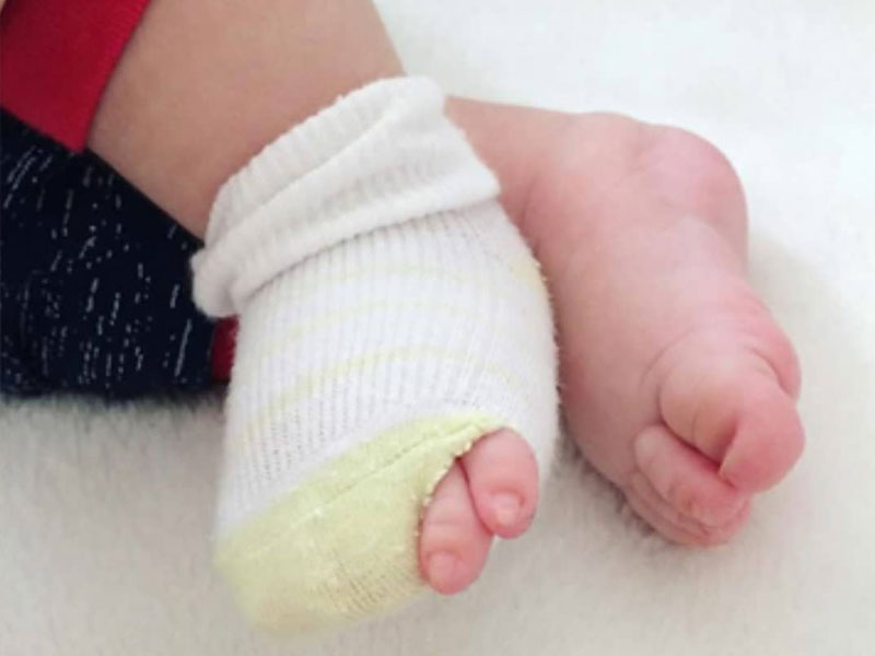 دلیل پاره شدن جوراب